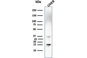 Western Blot Analysis of Liver tissue lysate using Transthyretin Mouse Monoclonal Antibody (CPTC-TTR-1). (TTR Antikörper)