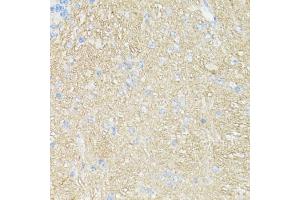 Immunohistochemistry of paraffin-embedded mouse brain using CD90/Thy1 antibody (ABIN7266228) at dilution of 1:100 (40x lens). (CD90 Antikörper  (AA 31-81))