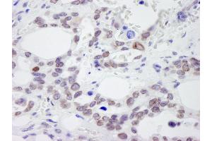 anti-Nucleoporin 214kDa (NUP214) (AA 1250-1300) antibody