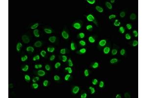 Immunofluorescence staining of Hela cells(treated with 100 mM EGF for 20 min) with ABIN7127752 at 1:206,counter-stained with DAPI. (Rekombinanter SNCA Antikörper  (pSer129))