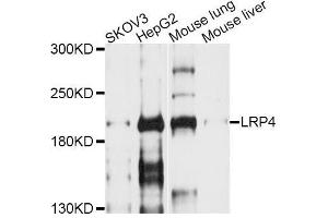Western blot analysis of extracts of various cell lines, using LRP4 antibody (ABIN6003867) at 1/1000 dilution. (LRP4 Antikörper)