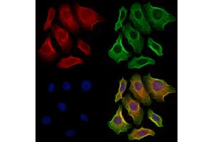 ABIN6264012 and ABIN6273286 staining Hela cells by IF/ICC. (PAFAH2 Antikörper  (Internal Region))