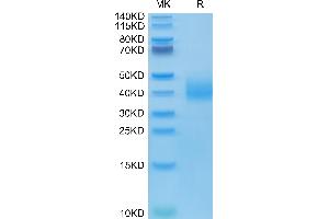 SLAMF6 Protein (AA 22-226) (His-Avi Tag)