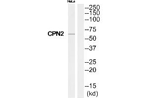 Western blot analysis of extracts from HeLa cells, using CPN2 antibody. (CPN2 Antikörper  (C-Term))