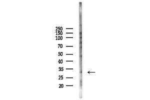 anti-Paired-Like Homeobox 2b (PHOX2B) (Internal Region) antibody