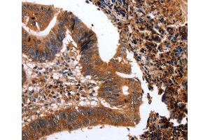 Immunohistochemistry (IHC) image for anti-C-Type Lectin Domain Family 4, Member A (CLEC4A) (AA 70-237) antibody (ABIN6219767) (CLEC4A Antikörper  (AA 70-237))