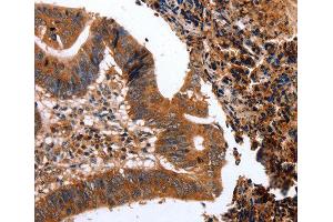 Immunohistochemistry (IHC) image for anti-C-Type Lectin Domain Family 4, Member A (CLEC4A) (AA 70-237) antibody (ABIN3016507)