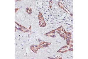 Western Blotting (WB) image for anti-RAP1A, Member of RAS Oncogene Family (RAP1A) (AA 50-150) antibody (ABIN3021200)