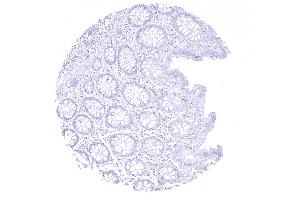 colon descendens mucosa (CPA1 Antikörper)