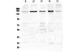 Western blot analysis of EEA1 using anti-EEA1 antibody . (EEA1 Antikörper)