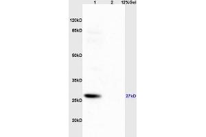 Lane 1: mouse brain lysates Lane 2: mouse pancreas lysates probed with Anti Phospho-S6 Ribosomal Protein (Ser235+Ser236) Polyclonal Antibody, Unconjugated (ABIN745583) at 1:200 in 4 °C. (RPS6 Antikörper  (pSer235, pSer236))