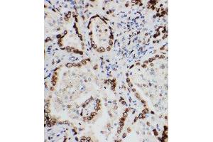 Immunohistochemistry (IHC) image for anti-Lamin A/C (LMNA) (AA 455-469), (C-Term) antibody (ABIN3043695)