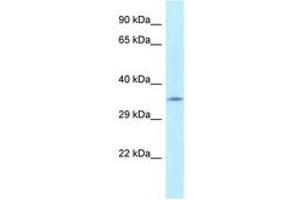 Image no. 1 for anti-Fumarylacetoacetate Hydrolase Domain Containing 2A (FAHD2A) (AA 28-77) antibody (ABIN6747792) (FAHD2A Antikörper  (AA 28-77))