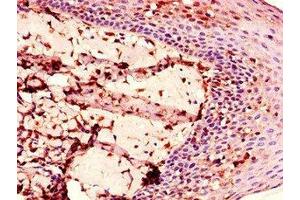 Immunohistochemistry of paraffin-embedded human tonsil tissue using ABIN7151381 at dilution of 1:100 (ENTPD8 Antikörper  (AA 30-434))