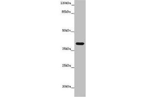 Western blot All lanes: MR1 antibody at 6 μg/mL + K562 whole cell lysate Secondary Goat polyclonal to rabbit IgG at 1/10000 dilution Predicted band size: 40, 35, 29, 26 kDa Observed band size: 40 kDa