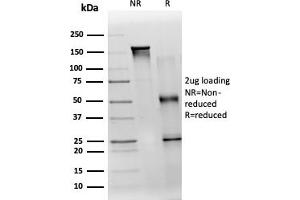 SDS-PAGE Analysis Purified TDRKH Mouse Monoclonal Antibody (PCRP-TDRKH-1H2). (TDRKH Antikörper)