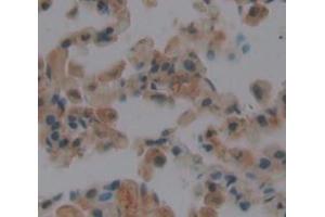 Used in DAB staining on fromalin fixed paraffin- embedded Kidney tissue (Endothelin 2 Antikörper  (AA 32-178))