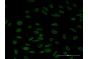 Immunofluorescence of monoclonal antibody to LSM6 on HeLa cell. (LSM6 Antikörper  (AA 1-80))