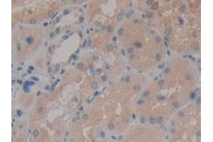 Immunohistochemistry (IHC) image for anti-Arginyl Aminopeptidase (Aminopeptidase B) (RNPEP) (AA 388-616) antibody (ABIN7443035)