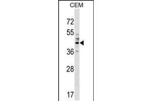 Western blot analysis in CEM cell line lysates (35ug/lane). (CEACAM6 Antikörper  (AA 188-214))