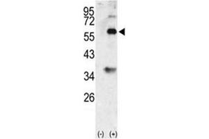 Western blot analysis of BMP3 antibody and 293 cell lysate (2 ug/lane) either nontransfected (Lane 1) or transiently transfected with the BMP3 gene (2). (BMP3 Antikörper  (AA 8-36))