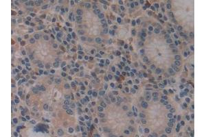 IHC-P analysis of Human Stomach Tissue, with DAB staining. (VPREB1 Antikörper  (AA 33-135))