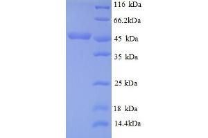 MetC (AA 1-392), (partial) protein (His tag)