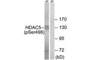 Western Blotting (WB) image for anti-Histone Deacetylase 5 (HDAC5) (pSer498) antibody (ABIN2888430) (HDAC5 Antikörper  (pSer498))