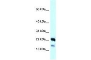 Image no. 1 for anti-NADH Dehydrogenase (Ubiquinone) 1 beta Subcomplex, 10, 22kDa (NDUFB10) (C-Term) antibody (ABIN6747916) (NDUFB10 Antikörper  (C-Term))
