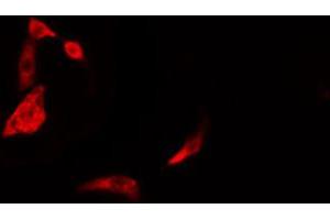 ABIN6274387 staining Hela cells by IF/ICC. (DAK Antikörper  (Internal Region))