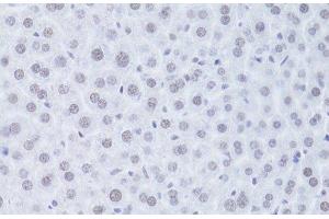 Immunohistochemistry of paraffin-embedded Mouse liver using CDKN1A Polyclonal Antibody at dilution of 1:100 (40x lens). (p21 Antikörper)