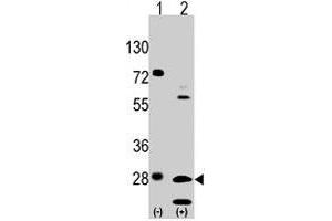 Western blot analysis of GRB2 (arrow) using rabbit GRB2 polyclonal antibody .