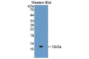 Western blot analysis of the recombinant protein. (Aggrecan Antikörper  (AA 587-684))