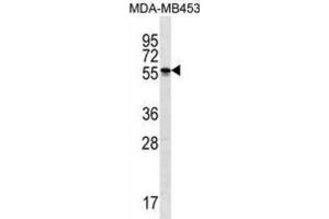 Western Blotting (WB) image for anti-Spermatogenesis and Oogenesis Specific Basic Helix-Loop-Helix 2 (SOHLH2) antibody (ABIN3000290)
