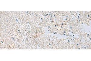 Immunohistochemistry of paraffin-embedded Human brain tissue using RDH5 Polyclonal Antibody at dilution of 1:50(x200)
