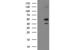 Image no. 1 for anti-Phosphatidylinositol-5-Phosphate 4-Kinase, Type II, alpha (PIP4K2A) antibody (ABIN1500226) (PIP4K2A Antikörper)