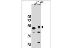 TIGD3 Antibody (C-term) (ABIN654995 and ABIN2844630) western blot analysis in HepG2 and HL-60 cell line lysates (35 μg/lane). (TIGD3 Antikörper  (C-Term))