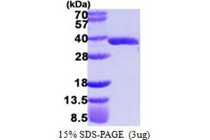SDS-PAGE (SDS) image for Glyoxalase Domain Containing 4 (GLOD4) (AA 1-298) protein (His tag) (ABIN667509) (GLOD4 Protein (AA 1-298) (His tag))