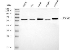 Western blot analysis of GPR161 using anti-GPR161 antibody (ABIN7602890).