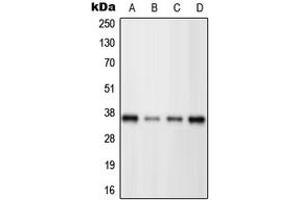 Western Blotting (WB) image for anti-POU Domain, Class 4, Transcription Factor 3 (POU4F3) (C-Term) antibody (ABIN7296644)