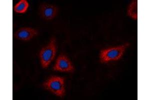 Immunofluorescent analysis of EGFR (pT693) staining in HEK293T cells. (EGFR Antikörper  (pSer693))