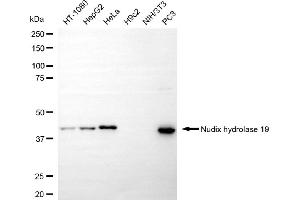 Western blotting analysis using nudix hydrolase 19 antibody (ABIN7799682). (Rekombinanter Nucleoside Diphosphate-Linked Moiety X Motif 19 (NUDT19) Antikörper)