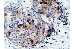 Image no. 2 for anti-CD80 (CD80) antibody (ABIN1497365)