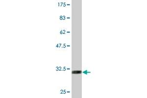Western Blotting (WB) image for anti-Solute Carrier Family 2 (Facilitated Glucose Transporter), Member 4 (SLC2A4) (AA 467-509) antibody (ABIN520227)