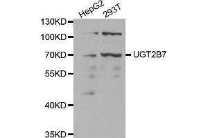 Western Blotting (WB) image for anti-UDP Glucuronosyltransferase 2 Family, Polypeptide B7 (UGT2B7) antibody (ABIN1875408) (UGT2B7 Antikörper)
