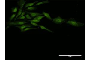 Immunofluorescence of purified MaxPab antibody to ZFP36 on HeLa cell. (ZFP36 Antikörper  (AA 1-326))