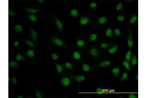 Immunofluorescence of monoclonal antibody to DHFR on HeLa cell. (Dihydrofolate Reductase Antikörper  (AA 88-187))