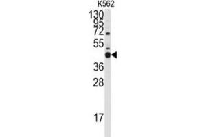 Western Blotting (WB) image for anti-BCL2-Like 14 (Apoptosis Facilitator) (BCL2L14) (BH3 Domain) antibody (ABIN2997105) (BCL2L14 Antikörper  (BH3 Domain))