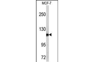 Western blot analysis of PSA antibody in MCF-7 cell line lysates (35ug/lane) (Prostate Specific Antigen Antikörper  (C-Term))