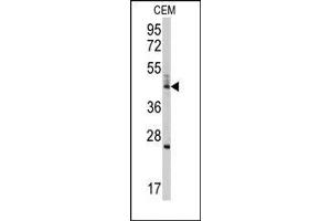 Image no. 1 for anti-BCL2-Like 13 (Apoptosis Facilitator) (BCL2L13) (Middle Region) antibody (ABIN360244) (BCL2L13 Antikörper  (Middle Region))